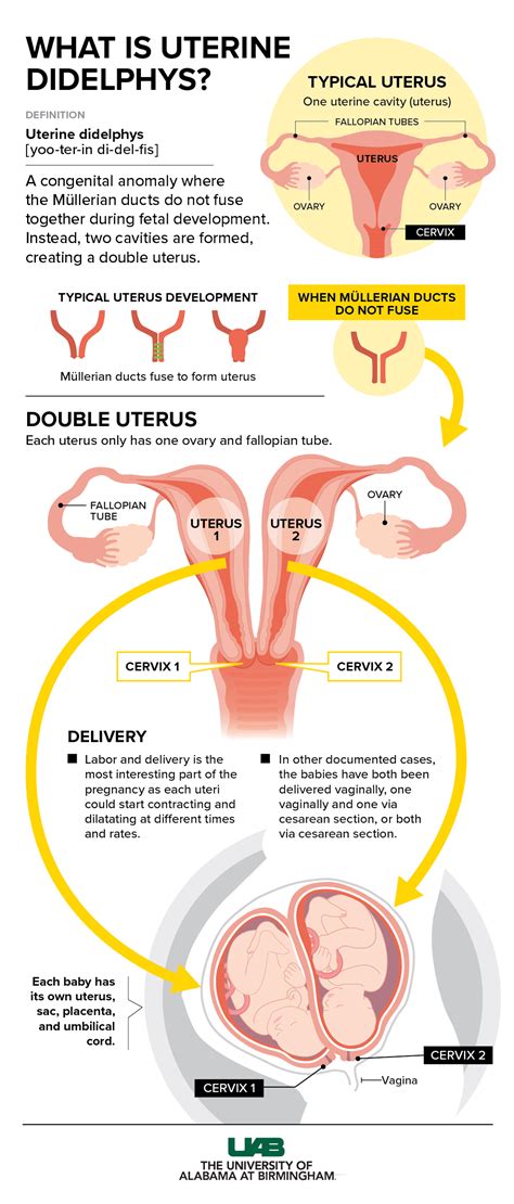 can women have 2 vaginas|Uterus Didelphys: A rare phenomenon where you。